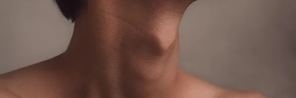 Understand The Body Language Of The Neck (The Forgotten Area)
